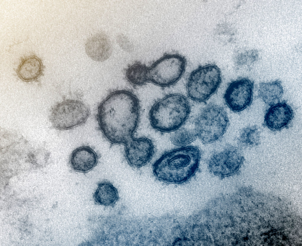 © NIAID. This transmission electron microscope image shows SARS-CoV-2—also known as 2019-nCoV, the virus that causes COVID-19